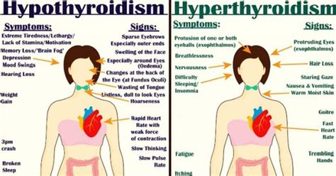 Everything You Need To Know About Every Thyroid Disorder Signs Symptoms Causes Treatments