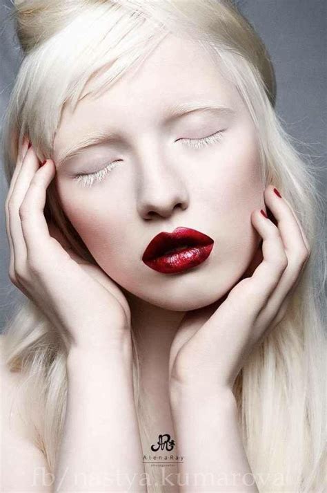 1000 Images About Nastya Zhidkova Albino Model On