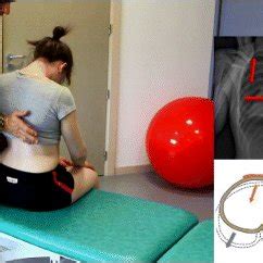 The Schroth Prone Exercise With Activation Of The Iliopsoas Muscle