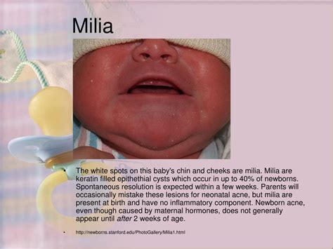 Ppt Newborn Appearance Powerpoint Presentation Free Download Id