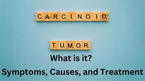 carcinoid tumors symptoms causes and treatment sprint medical