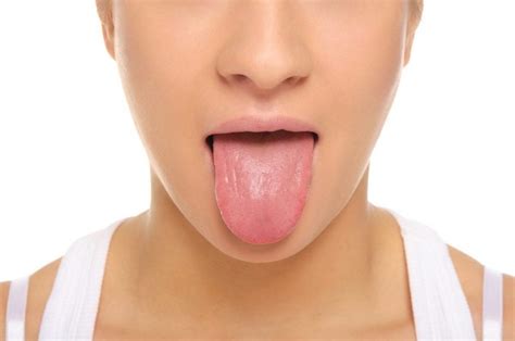 10 Things To Know About Geographic Tongue Facty Health