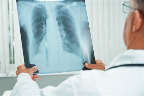 3 Reasons To See A Pulmonology Specialist If You Have Asthma Santiam