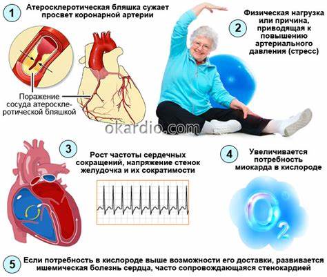 Ибс стенокардия напряжения диета Стенокардия напряжения 2 ФК: что это такое, причины и лечение Стенокардия напряжения 2 ФК: что это такое, причины и лечение Ибс стенокардия напряжения диета