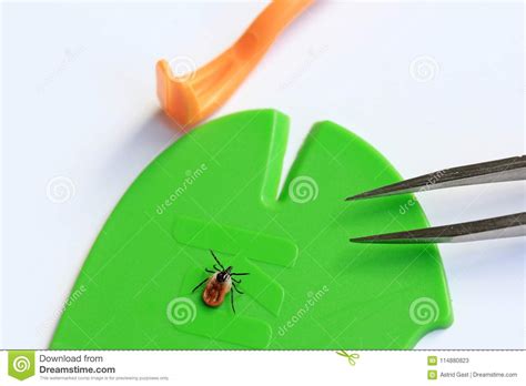Correct And Quick Removal Of A Tick With A Tick Hook Tweezers Or Tick