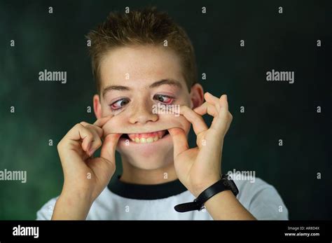 A Young Boy Making A Silly Face Stock Photo Alamy