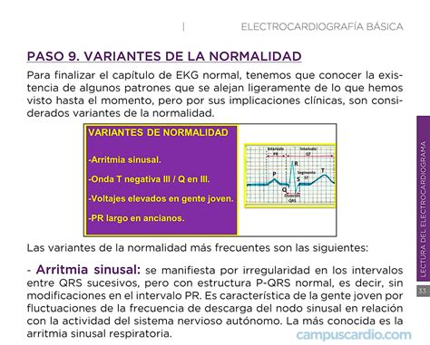 Arritmia Sinusal Pode Matar