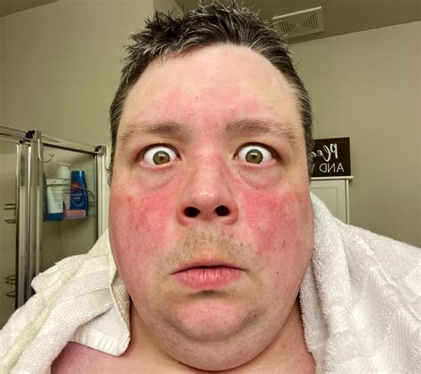 Barnacules Nerdgasm ™️ On Twitter Not Sure Why My Face Is Breaking