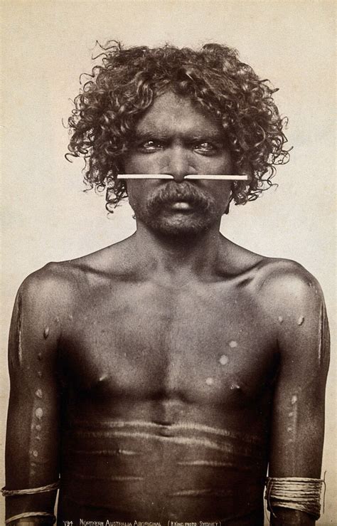Australia An Aboriginal Man Ned Woolnah With A Bone Through His