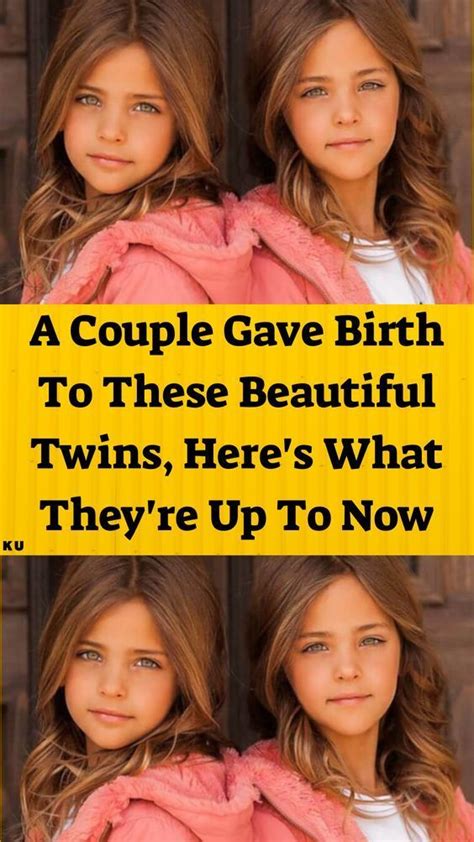 A Couple Gave Birth To These Beautiful Twins Here S What They Re Up To