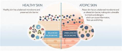 Mengenal Skin Microbiome Genetika Science