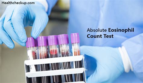 Absolute Eosinophil Count Test Aec Procedure Preparation And Results