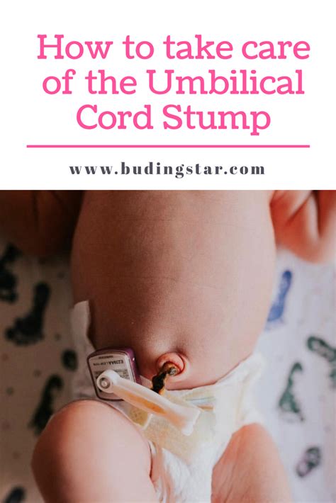 Umbilical Cord In Baby How To Care For It Naturally Artofit