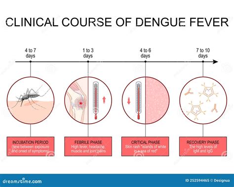 Dengue Fever Clinical Course Infographics Stock Vector Illustration