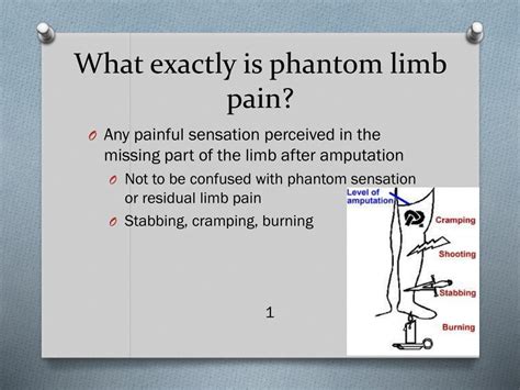 Ppt Treatment Options For Phantom Limb Pain Powerpoint Presentation