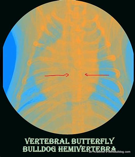 Spinal Hemivertebra Vertebral Disease In Bulldogs Vet4bulldog