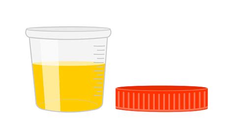 Free Urine Test Strip Clipart In Ai Svg Eps Or Psd Page 4