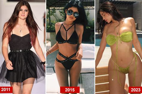 Kylie Jenner Before After Plastic Surgery Her Transformation Over The Years