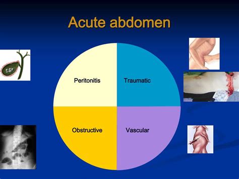Ppt The Acute Abdomen Powerpoint Presentation Free Download Id1392524