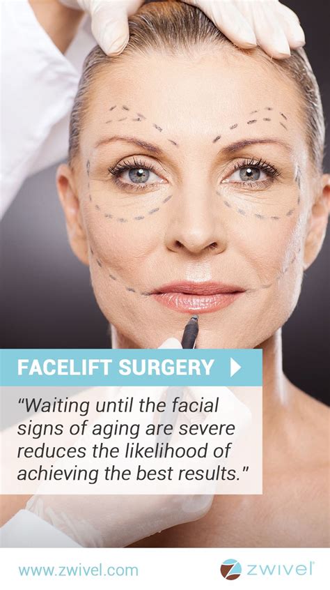 Zwivels Complete Guide To Facelift Surgery Rhytidectomy Face Lift