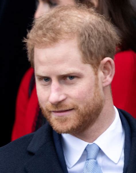 Prince harry, duke of sussex, kcvo, adc (henry charles albert david; Is Prince Harry wearing hair loss CONCEALER? Hair Expert warns Prince will be almost BALD in two ...