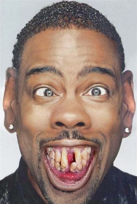 Ugly And Weird People Teeth Funnypica Funny Weird People Pictures 3 Ugly Teeth Chris