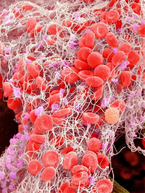 Blood on the dance floor by michael jackson is featured on the playstation 3, xbox 360, ios, playstation vita, and nintendo 3ds versions of michael jackson: Blood clot, SEM - Stock Image - C008/7565 - Science Photo ...