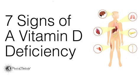 7 Signs Of A Vitamin D Deficiency