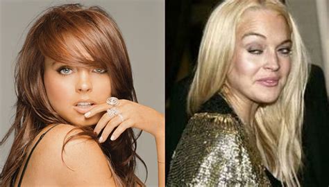 10 Botched Plastic Surgeries Youtube 187 Plastic Surgery Before And