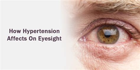 How Hypertension Affects On Eyesight