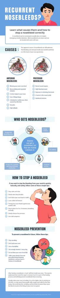 Nosebleed Dont Worry Heres How To Cure It Latest Infographics