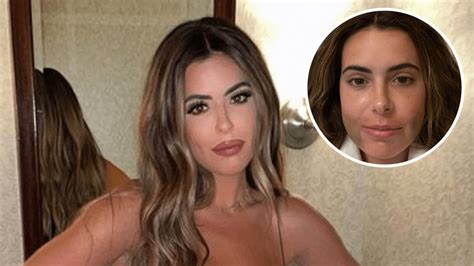Brielle Biermann S Double Jaw Surgery Before And After Photos Life And Style