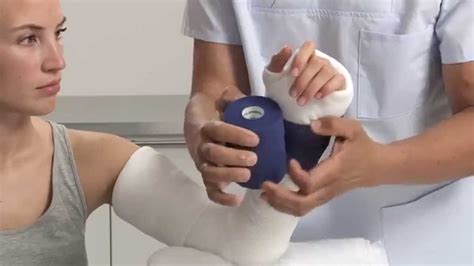 Plaster Of Paris Elbow Splint Application Youtube