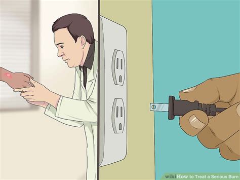 3 Ways To Treat A Serious Burn Wikihow