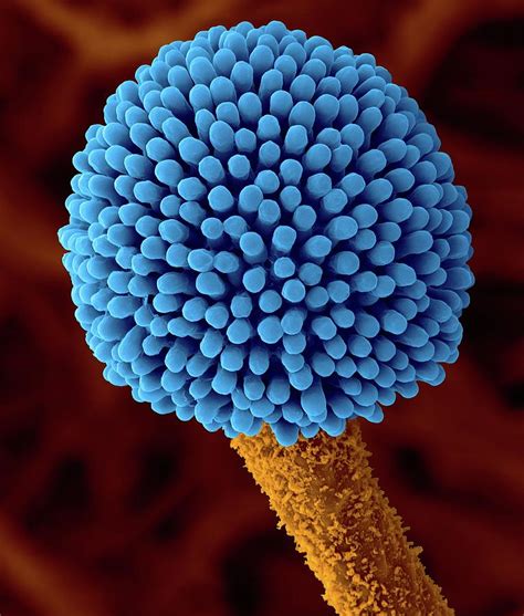 Aspergillus Sp Fruiting Structure Photograph By Dennis Kunkel