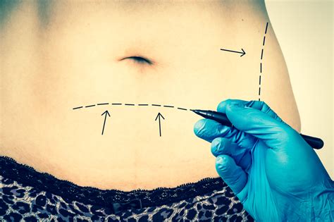Part of the cost for this procedure goes to operating room expenses. How Much Is a Tummy Tuck Cost In year 2020-2021?