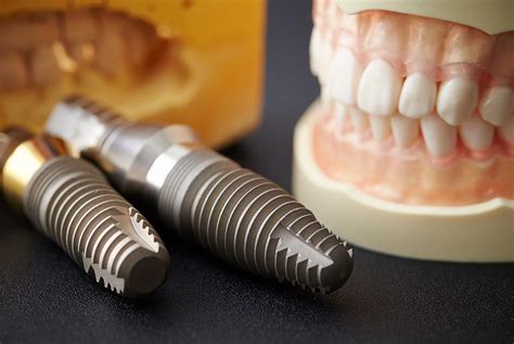 Oral Implants The Reason Why People Choose To Go Abroad Regarding