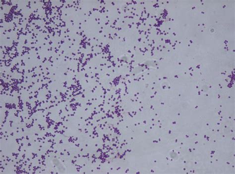 Staphylococcus Saprophyticus Gram Stain Medical Laboratories