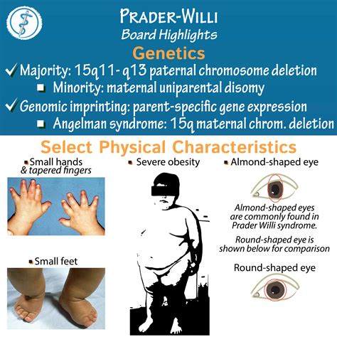 Clinical Pathology Glossary Prader Willi Syndrome Ditki Medical