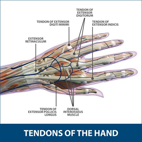 Finger Dislocation Florida Orthopaedic Institute