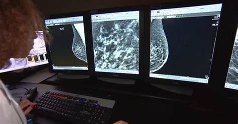 what women need to know about dense breast tissue mammograms and breast cancer cbs news