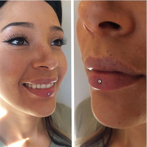Pictures Of Infected Lip Piercings Pin On Ear Piercing Ideas Jay Forkeded