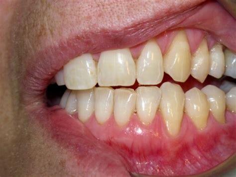 How Your Gums Should Look