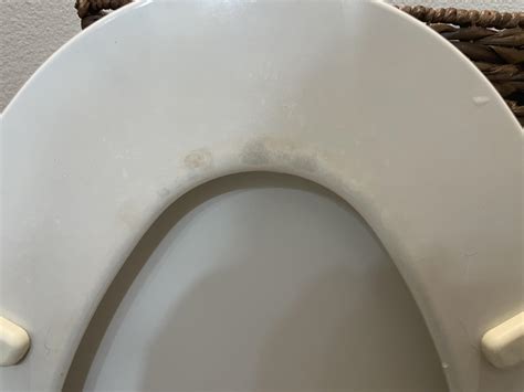 How To Clean Bottom Of Toilet Seat Rcleaningtips