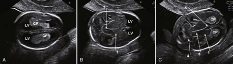 Fetal Anatomy Ultrasound