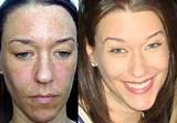 Photos of How To Cover Brown Spots On Face With Makeup