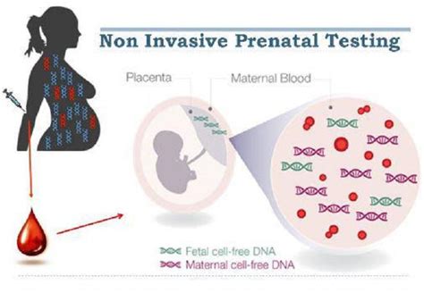 Non Invasive Prenatal Testing Pacific Rim Pathology