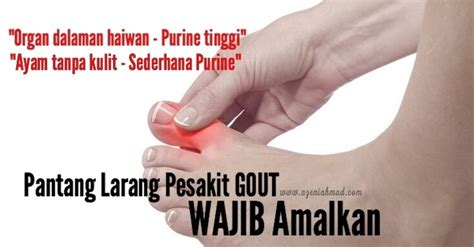 Asid urik adalah bahan kumuhan berasal dari sejenis protein yang dipanggil purin. Pantang Larang Pesakit Gout Wajib Diamalkan - azeniahmad.com