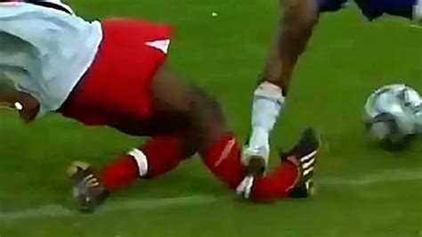 Top 10 Worst Leg Breaks In Football History Football Post