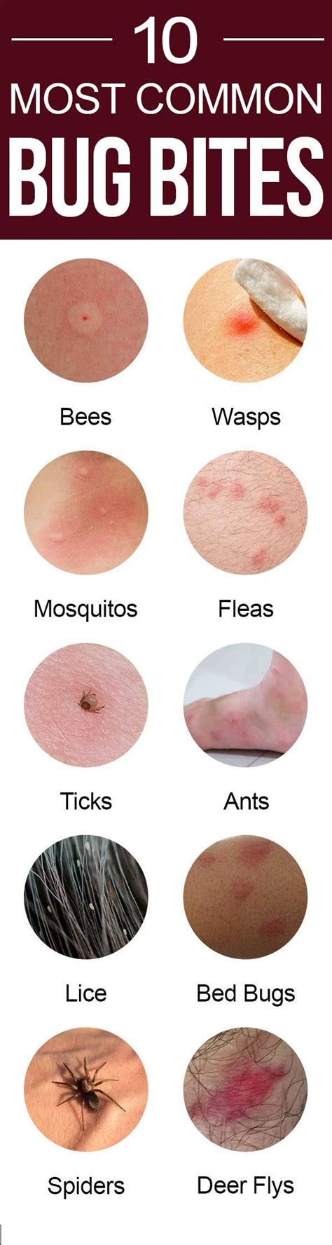 10 Most Common Bug Bites And How To Identify Them Allmondo Lifestyle